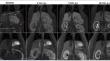 Assessment of hepatic transporter function in rats using dynamic gadoxetate-enhanced MRI: a reproducibility study.