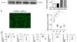 Effects of the S1P/S1PR1 Signaling Pathway on High Glucose-Induced NRK-52E Epithelial-Mesenchymal Transition Via Regulation of ROS/NLRP3.