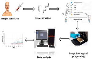 miR-762 as biomarker in Graves’ ophthalmopathy patients