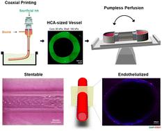 Coaxial bioprinting of a stentable and endothelialized human coronary artery-sized in vitro model†