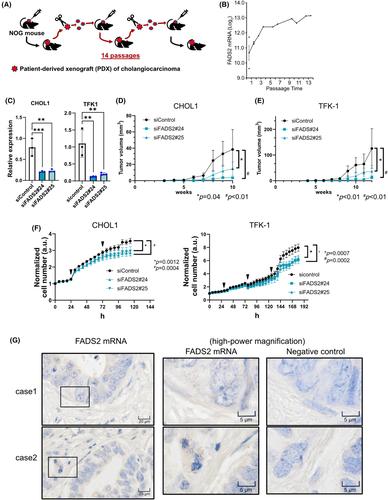 Delta-6 desaturase FADS2 is a tumor-promoting factor in cholangiocarcinoma