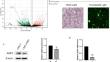 Aquaporin-3 is down-regulated by LMP1 in nasopharyngeal carcinoma cells to regulate cell migration and affect EBV latent infection.