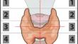 The detection of pathological parathyroid glands is facilitated by identifying vascular features on ultrasound: the potential benefit of a low-frequency vascular probe.