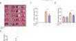 Minocycline alleviates microglia ferroptosis by inhibiting HO-1 during cerebral ischemia-reperfusion injury.