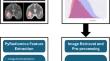 Radiomics features for the discrimination of tuberculomas from high grade gliomas and metastasis: a multimodal study.