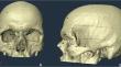 Facial soft tissue depth of a contemporary adult Greek population.