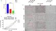 Iron Overloading Potentiates the Antitumor Activity of 5-Fluorouracil by Promoting Apoptosis and Ferroptosis in Colorectal Cancer Cells.