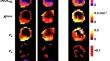 Measuring repeatability of dynamic contrast-enhanced MRI biomarkers improves evaluation of biological response to radiotherapy in lung cancer.