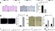 MicroRNA-128-3p Affects Neuronal Apoptosis and Neurobehavior in Cerebral Palsy Rats by Targeting E3 Ubiquitin-Linking Enzyme Smurf2 and Regulating YY1 Expression.