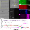 Enhanced superconductivity in 
<mml:math xmlns:mml="http://www.w3.org/1998/Math/MathML"><mml:msub><mml:mi>SrTiO</mml:mi><mml:mn>3</mml:mn></mml:msub></mml:math>
-based interfaces via amorphous 
<mml:math xmlns:mml="http://www.w3.org/1998/Math/MathML"><mml:mrow><mml:msub><mml:mi>Al</mml:mi><mml:mn>2<