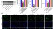 SIGMAR1 targets AMPK/ULK1 pathway to inhibit SH-SY5Y cell apoptosis by regulating endoplasmic reticulum stress and autophagy