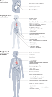 Cystic fibrosis.