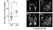 Alx3 deficiency disrupts energy homeostasis, alters body composition, and impairs hypothalamic regulation of food intake.