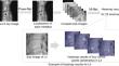 Heatmap-Based Active Shape Model for Landmark Detection in Lumbar X-ray Images.