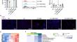 S100A8/A9-activated IFNγ<sup>+</sup> NK cells trigger β-cell necroptosis in hepatitis B virus-associated liver cirrhosis.