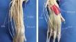 Variations in the anatomy of the extensor tendons of the manus in the domestic cat (Felis catus) with a revision of their common pattern: a cadaveric study