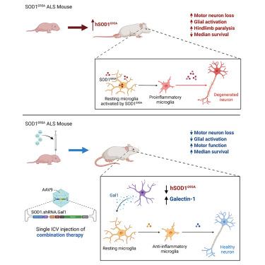 Combination AAV Gene Therapy with Galectin-1 and SOD1 Downregulation Demonstrates Superior Therapeutic Effect in a severe mouse model of ALS