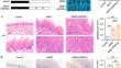 Dental pulp stem cells promote malignant transformation of oral epithelial cells through mitochondrial transfer.