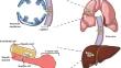 MicroRNA as Key Players in Hepatocellular Carcinoma: Insights into Their Role in Metastasis.