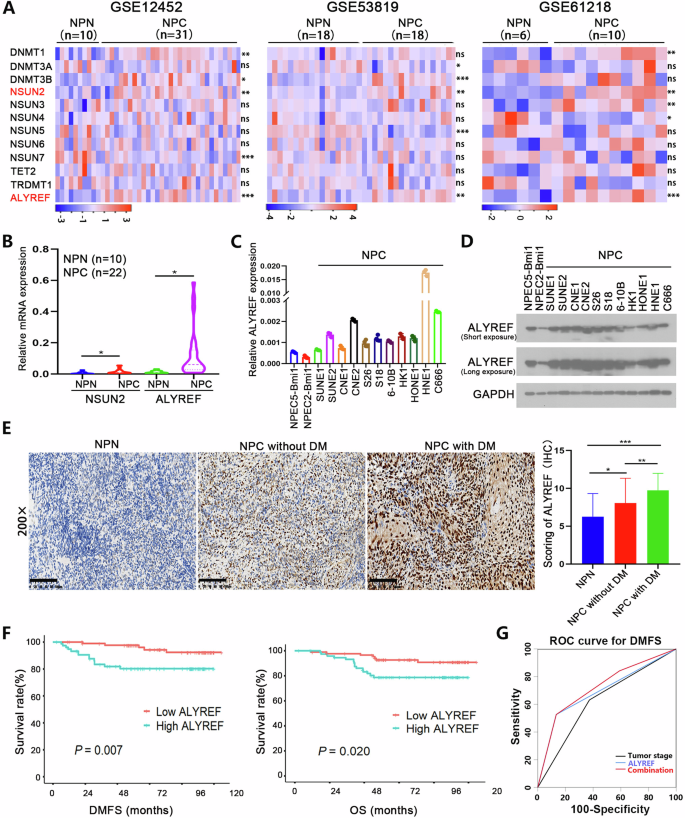 ALYREF promotes the metastasis of nasopharyngeal carcinoma by increasing the stability of NOTCH1 mRNA.