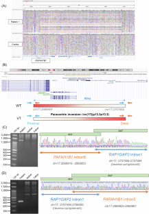 Exploring unsolved cases of lissencephaly spectrum: integrating exome and genome sequencing for higher diagnostic yield.