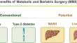 Resmetirom and Metabolic Dysfunction-Associated Steatohepatitis: Perspectives on Multidisciplinary Management from Global Healthcare Professionals.