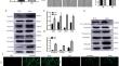 The effects of BMP2 and the mechanisms involved in the invasion and angiogenesis of IDH1 mutant glioma cells.