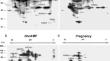 Unveiling the role of protein kinase A (PKA) activity in bovine oviductal epithelial cells: implications on apoptotic signaling pathways during the estrous cycle.