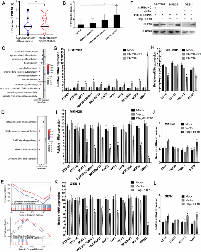 PHF10 inhibits gastric epithelium differentiation and induces gastric cancer carcinogenesis