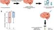 Predicting recurrent glioblastoma clinical outcome to immune checkpoint inhibition and low-dose bevacizumab with tumor in situ fluid circulating tumor DNA analysis.