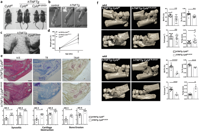 Cyld restrains the hyperactivation of synovial fibroblasts in inflammatory arthritis by regulating the TAK1/IKK2 signaling axis.