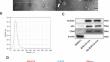 Exosomes derived from BMSCs in osteogenic differentiation promote type H blood vessel angiogenesis through miR-150-5p mediated metabolic reprogramming of endothelial cells.