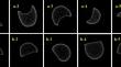 Phenotype identification and genome-wide association study of ear-internode vascular bundles in maize (Zea mays).