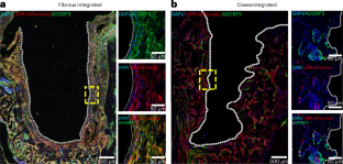 The formation and maintenance of peri-implant fibrosis requires skeletal cells expressing the leptin receptor