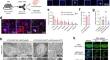 Microglia contribute to polyG-dependent neurodegeneration in neuronal intranuclear inclusion disease