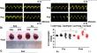 Cardioprotection of voluntary exercise against breast cancer-induced cardiac injury via STAT3.