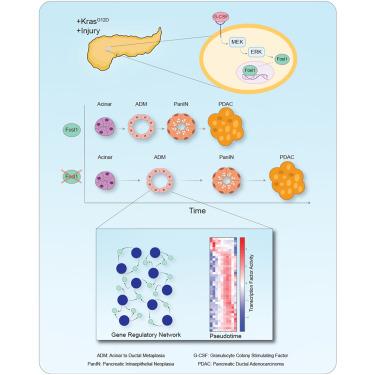 FRA1 controls acinar cell plasticity during murine KrasG12D-induced pancreatic acinar to ductal metaplasia