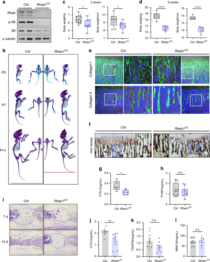 Osteoclasts control endochondral ossification via regulating acetyl-CoA availability