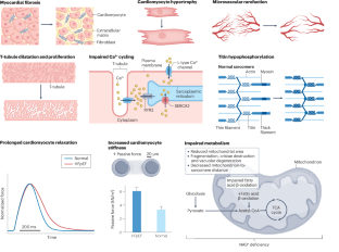 Pathophysiological insights into HFpEF from studies of human cardiac tissue