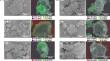 Insights into soil phosphorus bioavailability increase induced by periphytic biofilm decomposition: a comparison with straw decomposition