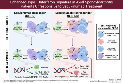 Enhanced Type 1 Interferon Signature in Axial Spondyloarthritis Patients Unresponsive to Secukinumab Treatment.