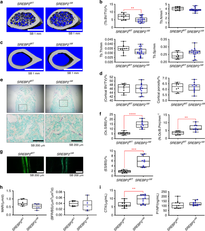 SREBP2 restricts osteoclast differentiation and activity by regulating IRF7 and limits inflammatory bone erosion.