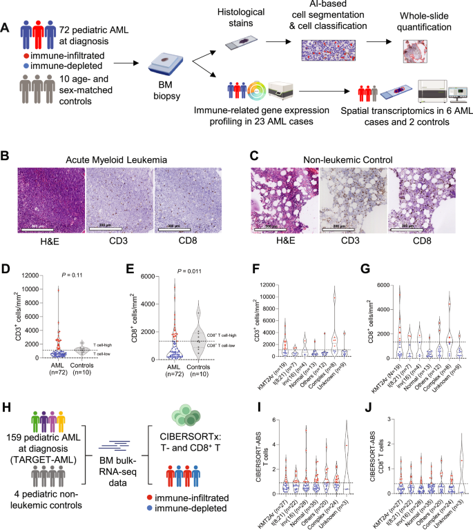 A multidimensional analysis reveals distinct immune phenotypes and the composition of immune aggregates in pediatric acute myeloid leukemia.