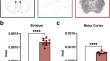 Preclinical evaluation of the novel [<sup>18</sup>F]CHDI-650 PET ligand for non-invasive quantification of mutant huntingtin aggregates in Huntington's disease.