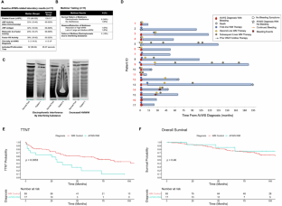 The clinical impact of acquired von Willebrand syndrome secondary to Waldenström macroglobulinemia: an underrecognized source of major bleeding events