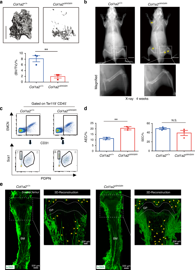 Schnurri-3 inhibition rescues skeletal fragility and vascular skeletal stem cell niche pathology in the OIM model of osteogenesis imperfecta.