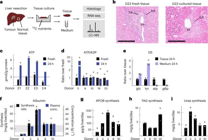 Global 13C tracing and metabolic flux analysis of intact human liver tissue ex vivo