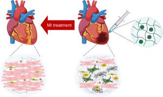 An injectable hydrogel containing versatile nanoparticles with antioxidant and antifibrotic properties for myocardial infarction treatment