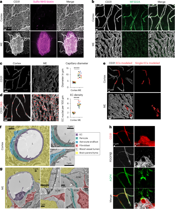 Characteristics of blood–brain barrier heterogeneity between brain regions revealed by profiling vascular and perivascular cells