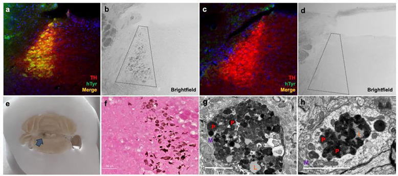 Tyrosinase-induced neuromelanin accumulation triggers rapid dysregulation and degeneration of the mouse locus coeruleus.